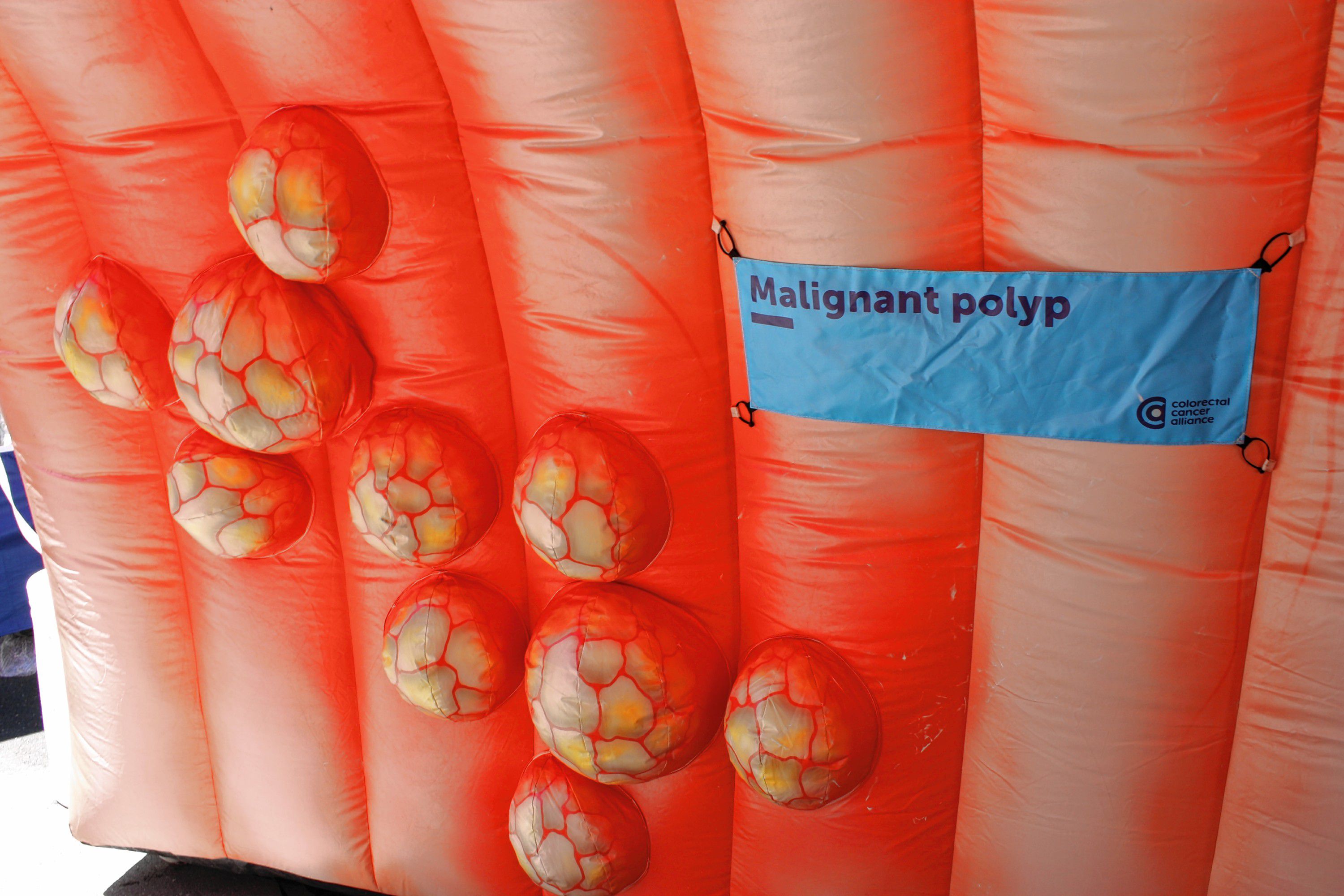 Ever seen a super-sized depiction of a malignant colon polyp? Luckily, this exact attraction was at Market Days, which was a hit with the kids despite the odd nature of the thing.  JON BODELL / Insider staff